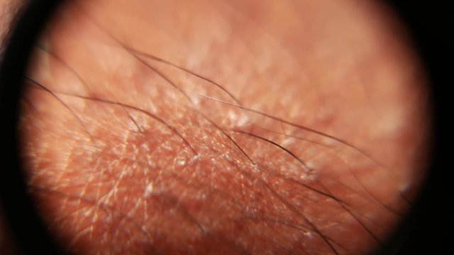 Close up of Human Skin Texture 
