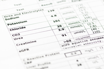 Blood chemistry report showing normal urea and electrolyte levels  (sodium, potassium, chloride,...
