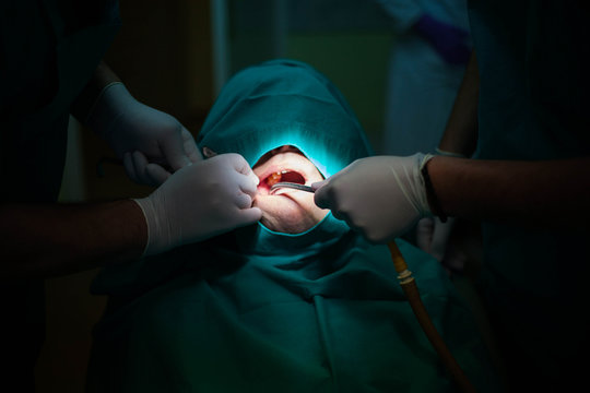 Doctor hands operating on a man's teeth