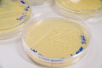 Close-up detail of multiple plates of petri dishes containing cultures of Methicillin-Resistant Staphylococcus Aureus (MRSA). Healthcare and infectious diseases concept. - 166404173