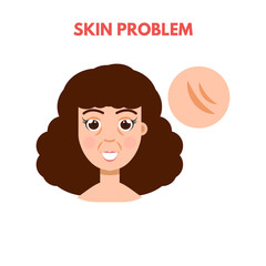 Woman with skin problem. Vector illustration