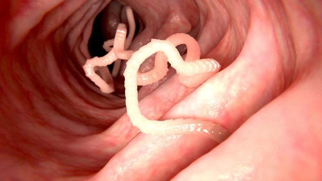 Human tapeworm infection, animation