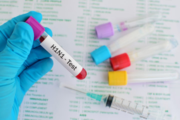 Blood sample for H1N1 influenza virus test
