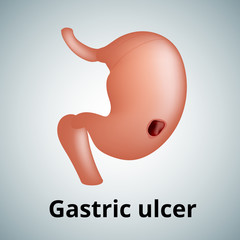 Realistic human sick stomach isolated on white background.