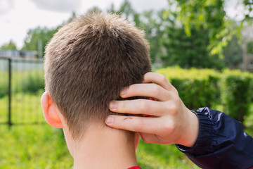 A young man scratches his head. Back view. The problem of dandruff in men. Green park background. Natural. The man holds his head