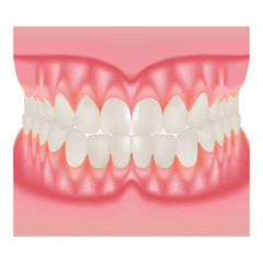 Dentures With White Teeth, Dentition The Gums Of The Upper And Lower Jaw, The Bite In Occlusion Isolated On A White Background. Vector Illustration. Stomatology. Teeth And Tooth Concept Of Dental