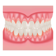 Dentures With White Teeth, Dentition The Gums Of The Upper And Lower Jaw, The Bite In Occlusion Isolated On A White Background. Vector Illustration. Stomatology. Teeth And Tooth Concept Of Dental