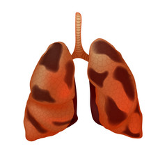 Realistic human sick lungs isolated on white background.