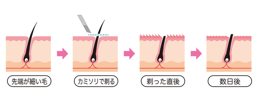 126 Best 自己処理 Images Stock Photos Vectors Adobe Stock