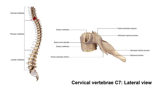 Cervical vertebrae C7_Lateral view