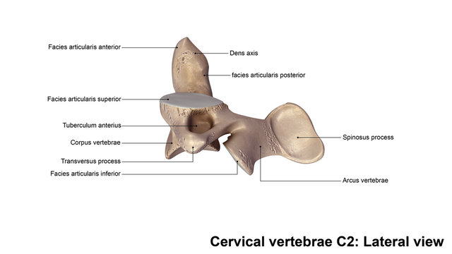 Cervical vertebrae C2_Lateral view
