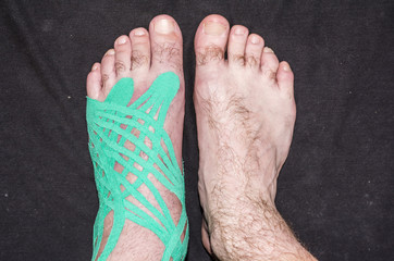 Fototapeta premium Compare foot with taping slices and healthy.