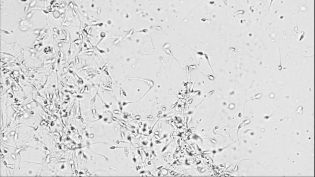 Sperm movement seen under microscope footage