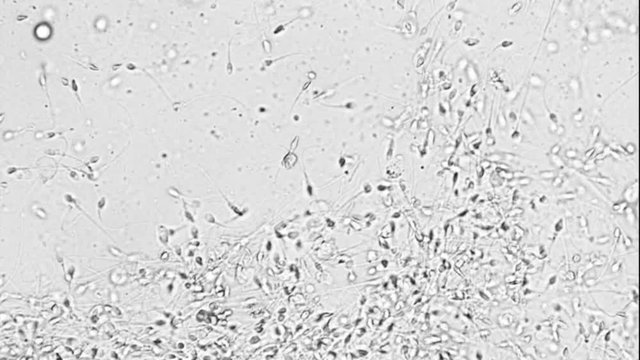 Sperm movement seen under microscope footage