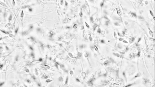 Sperm movement microscopic footage