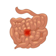 Realistic human sick small intestine isolated on white background.