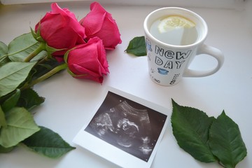 
Ultrasound. Child. A happy event.