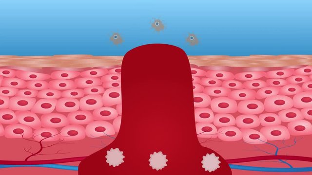 wound bleeding and skin graphic . anatomy