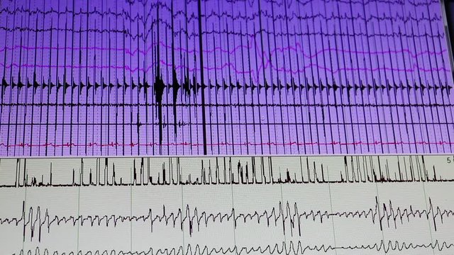 White and violet monitor screen with moving lines.