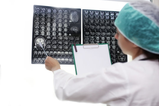 Doctor holding a picture of a brain MRI