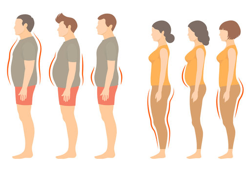 obesity woman and man body type, vector figure overweight