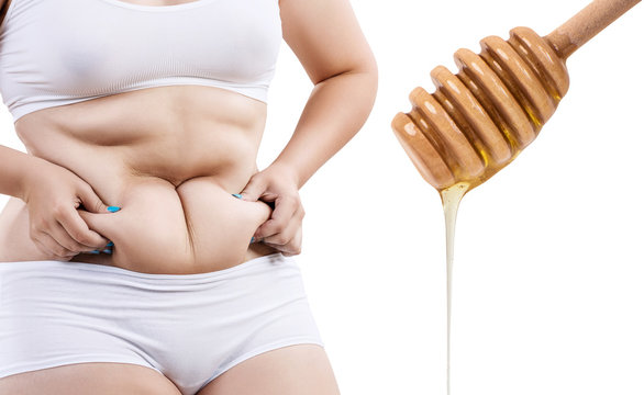 Fat woman preparing for honey massage.