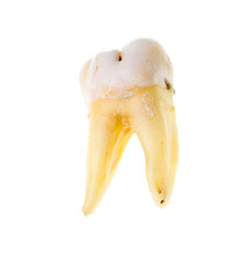 Old torn tooth on a white background