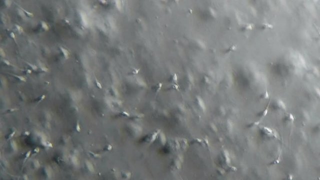 Sperm Sample Fertility Test 600x Phase Contrast Microscope