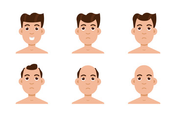 Hair stages loss. Types of baldness on male head vector.