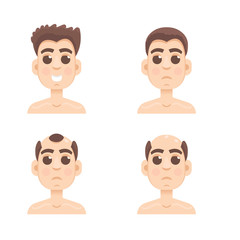 Hair stages loss. Types of baldness on male head vector.