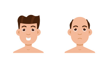 Hair stages loss. Types of baldness on male head vector.
