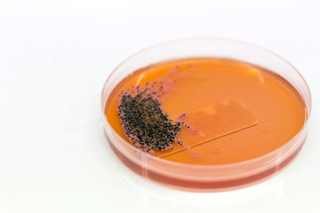 Bacteria in culture media.