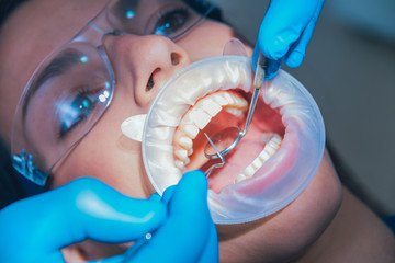 Dental treatment with expander. Modern technology