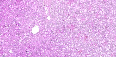 Kidney tissue of a human