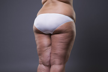 Overweight woman with fat legs and buttocks, obesity female body
