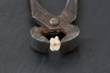 The removed tooth and pliers