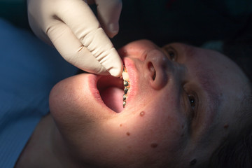 The dentist works with the client in the clinic