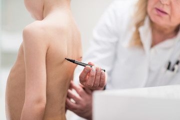 Physical therapist examining posture of a little boy