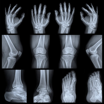 R&ouml;ntgenbilder H&auml;nde, Knie, F&uuml;&szlig;e