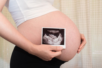 Pregnant woman show ultrasound baby photos, baby coming soon on the world