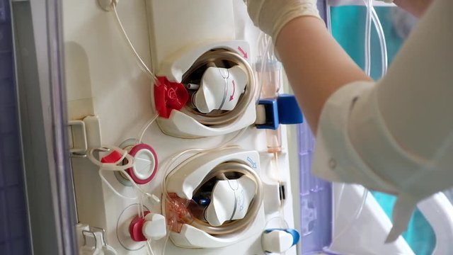 The doctor adjusts the machine for hemodialysis