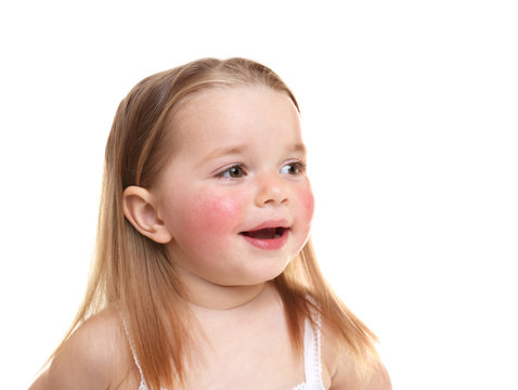 Portrait of little girl with diathesis symptoms on cheeks, against white background