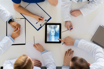 doctors with spine x-ray on tablet pc computer