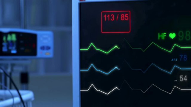 Cinemagraph of pulse checking E.C.G Monitor with pulse