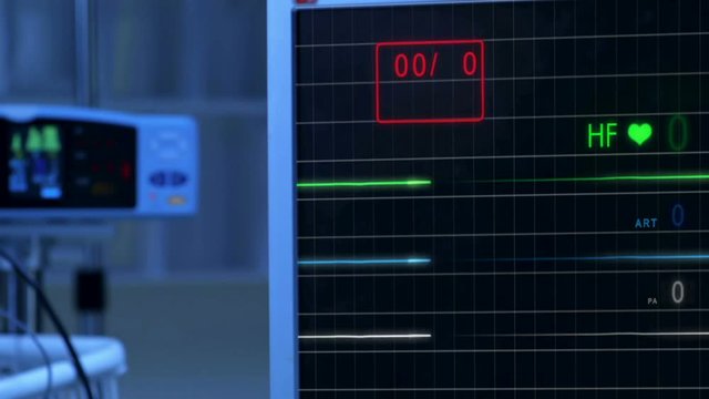 Cinemagraph of pulse checking E.C.G Monitor without pulse