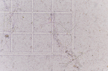 Branching budding yeast cells with pseudohyphae