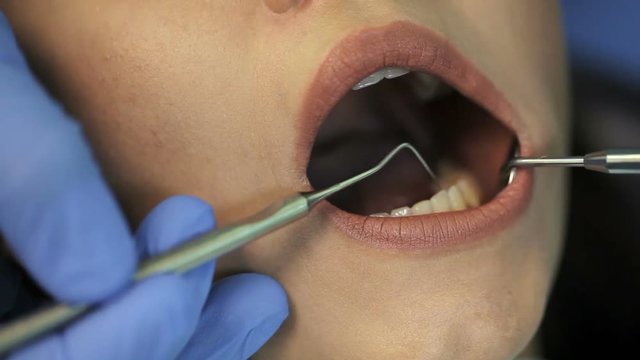 Doctor doing dental treatment to his patient in clinic