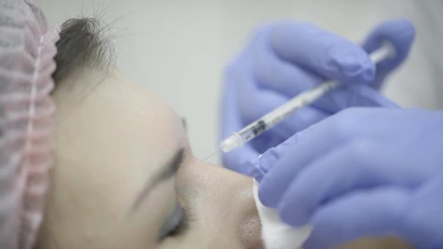 Cosmetologist makes injections Botox in nose and forehead of woman in clinic. She accurately punctures skin of patient with metal syringe needle, injects drug, rubs with cotton swab, and moves on to