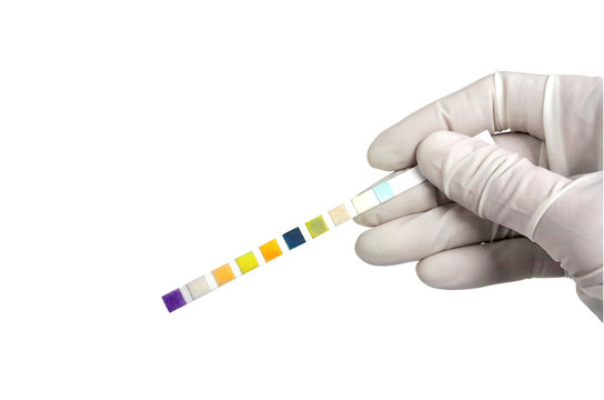 Hand In White Glove Holding Urine Strip Positive Leukocyte Esterase For Diagnosis Urinary Tract Infection  Isolated On White Background With Clipping Path.