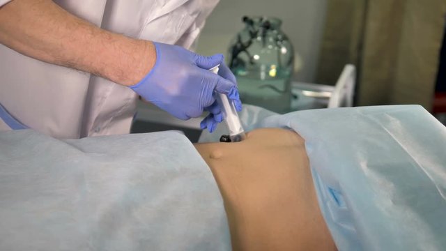 A doctor slowly placing a leech on patients skin.